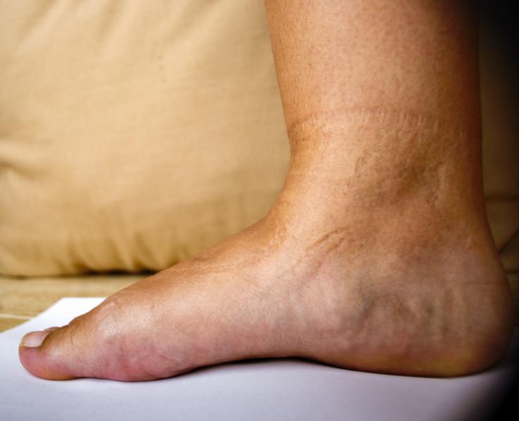 Stopalo | Foto: Shutterstock