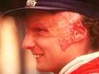 Niki Lauda 1976