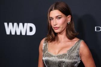 Hailey Bieber promovira trend, ki lahko bolj škodi kot koristi