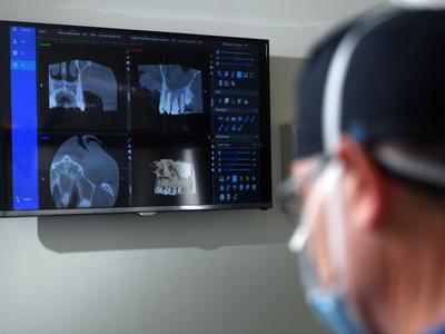 Sodobne metode takojšnjega nadomeščanja brezzobosti: All-on-4 in subperiostalni implantati