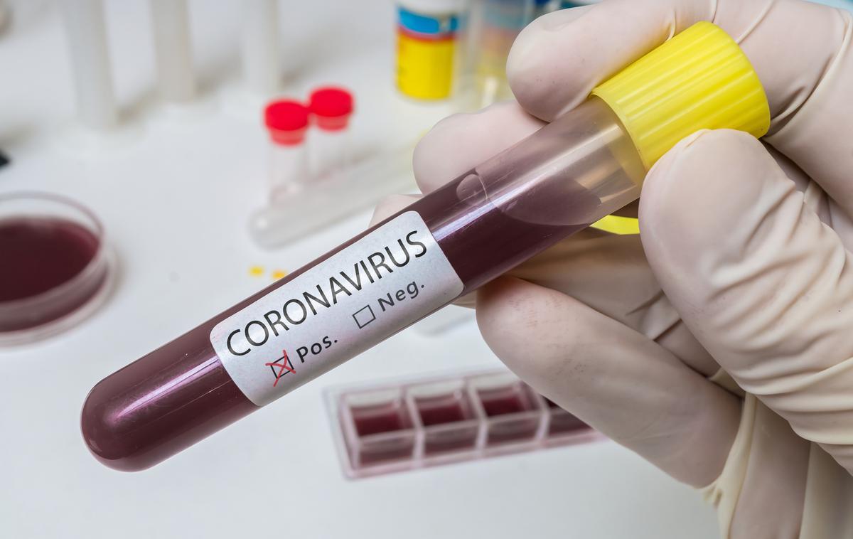 Koronavirus | Kljub večkratnim opozorilom ljudje še vedno ne upoštevajo navodil, kako ravnati v primeru suma na okužbo z novim koronavirusom. | Foto Getty Images