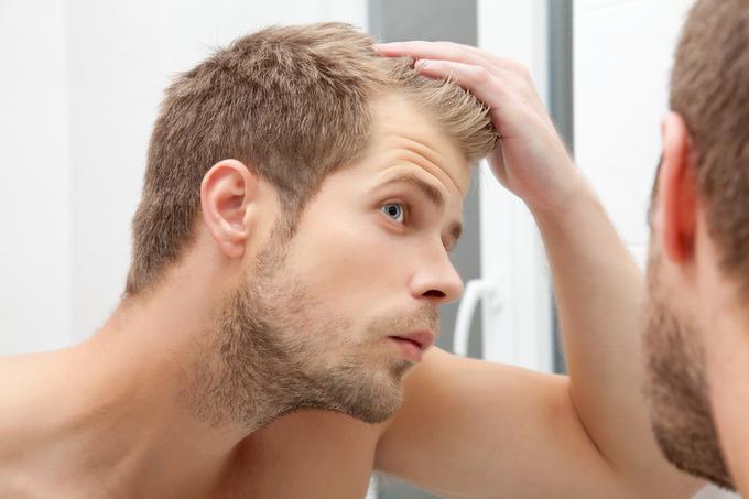 moški lasje | Foto: Getty Images