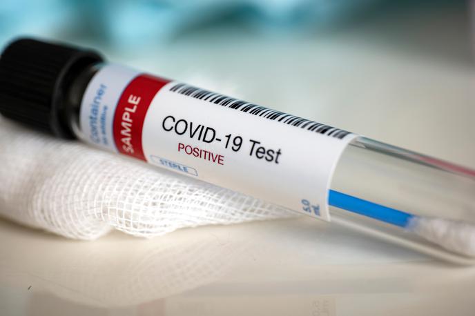 Koronavirus, Korona. Covid. Covid-19. Cepjenje. Test. Testiranje. Maske. | V četrtek so potrdili 1.484 okužb s koronavirusom. | Foto Shutterstock