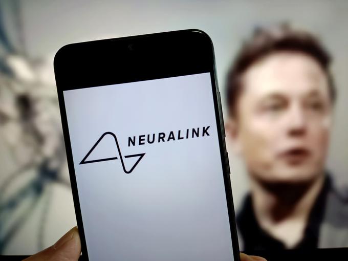 Neuralink, Elon Musk | Foto: Guliverimage