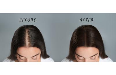 Metoda, ki obnovi lase v 21 dneh in je primerna za vsakogar