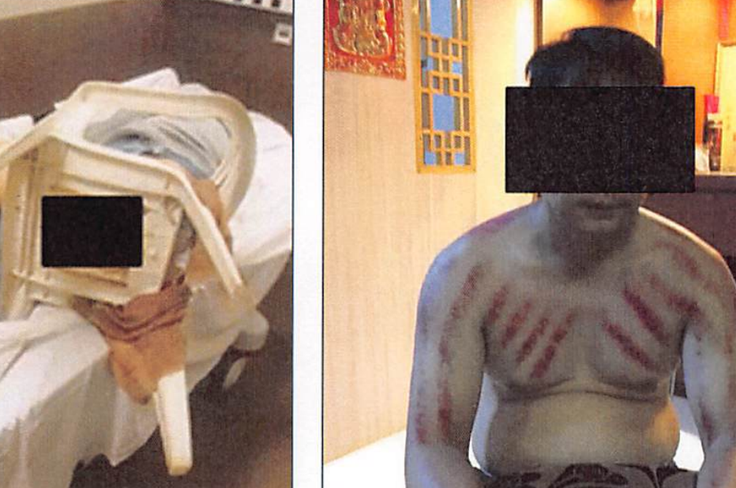 Fotografiji dveh prisilnih delavcev, ki sta bila žrtvi mučenja oziroma brutalnega izživljanja paznikov.  | Foto: Pravosodno ministrstvo ZDA