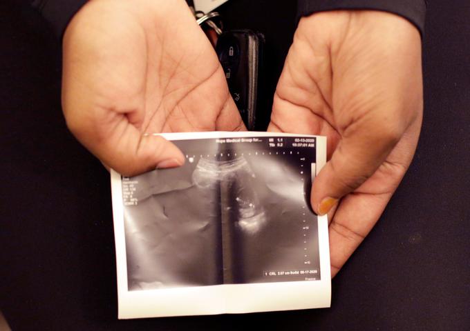 Zakon prepoveduje umetno prekinitev nosečnosti približno šest tednov po zanositvi. | Foto: Reuters