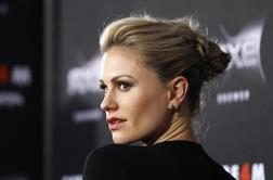 Razmik med sprednjimi zobmi ni lepotna napaka