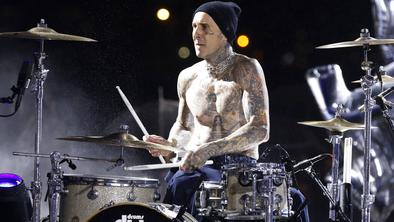 Rocker pokazal sledi "bojnih ran" s koncerta