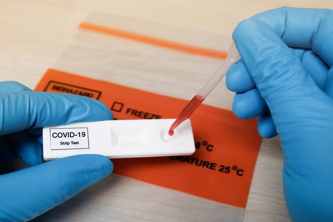 Koronavirus, bris, test, testiranje, covid-19 | Foto Getty Images