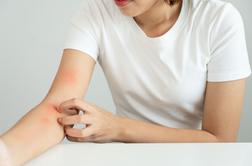 Multidisciplinarni pristop k lupusu: pomen fizioterapije