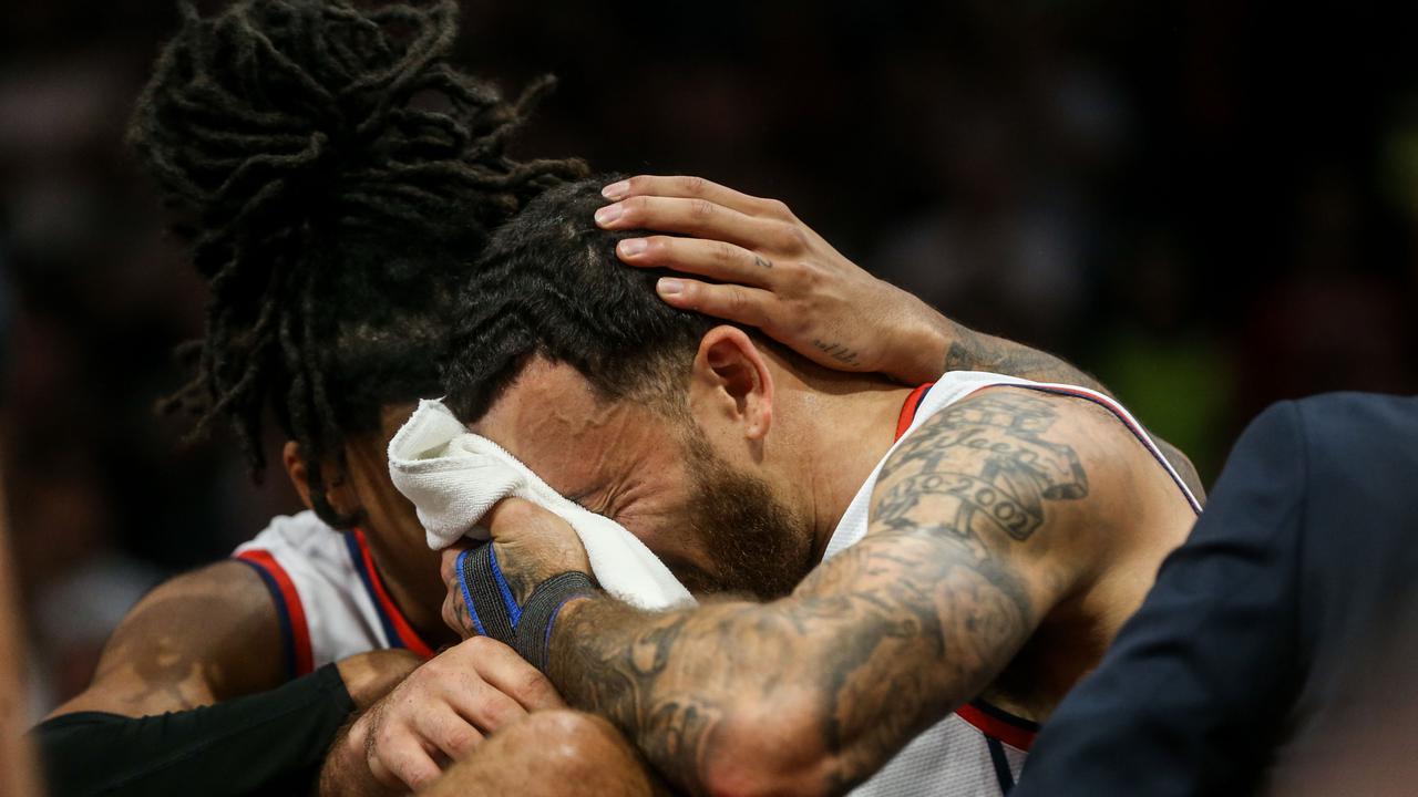 Mike James po hudi poškodbi končal na nosilih: Prekleto grozno