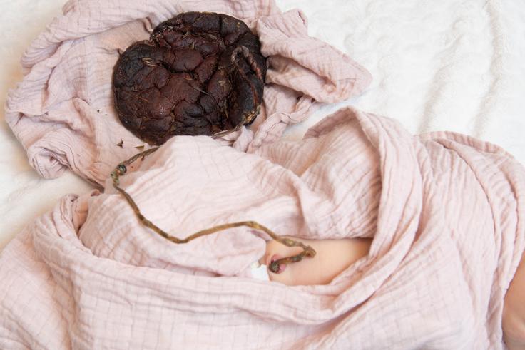 Posteljica ali placenta je začasni organ, ki se razvije med nosečnostjo iz tkiv matere in ploda. | Foto: Shutterstock