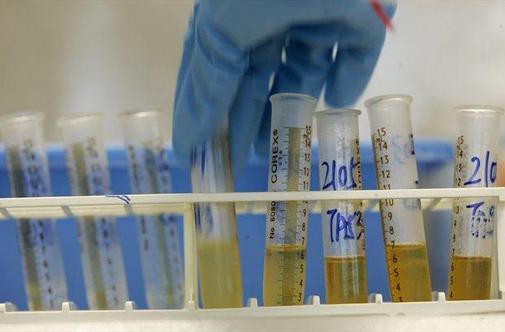 Wada napovedala novost v boju proti dopingu