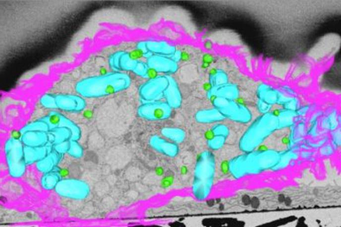 maščobe, bakterije | Makrofag, v katerem invazivno bakterijo (modro) napadajo "oborožene" kapljice maščobe (tirkizno). | Foto University of Queensland