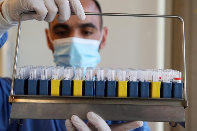 Laboratorij | Po svetu poteka več raziskav, kako dolgo traja imunost proti covid-19. | Foto Reuters