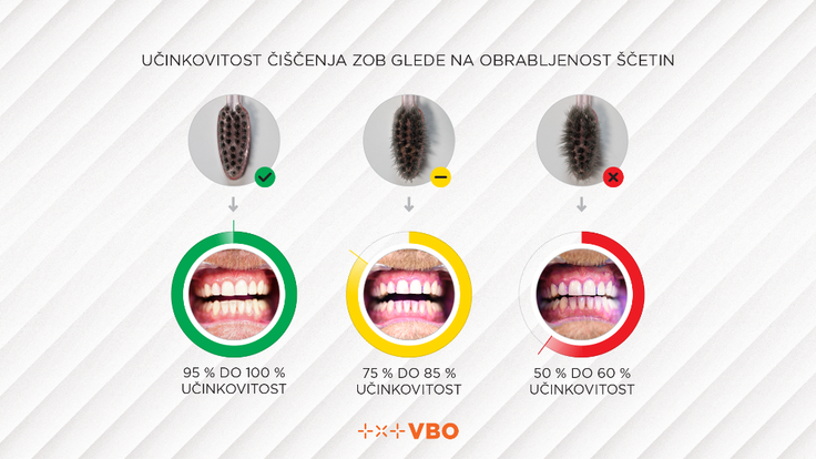 Zobna ščetka hitro izgubi svojo pravo funkcijo, tudi do 50 odstotkov. | Foto: Digitalno zobozdravstvo VBO