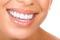 Minuta za zdravje: do belih zob na naraven način