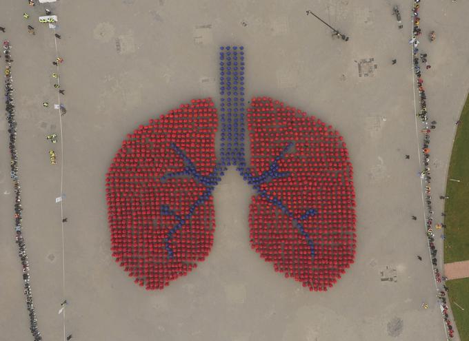 Zračni pogled na pljuča. V Pekingu na Kitajskem so leta 2015 želeli ustvariti največja pljuča na svetu in se vpisati v Guinnessovo knjigo rekordov. Instalaciji, ki jo je tamkajšnja zdravstvena organizacija postavila z namenom ozaveščanja o pomenu zdravja pljuč, se je pridružilo več kot 1.500 ljudi. | Foto: Reuters