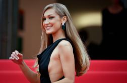 Operacija nosu, ki jo ljudje največkrat obžalujejo