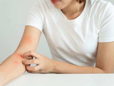 Lupus – zakaj je smiselno obiskati tudi fizioterapevta?