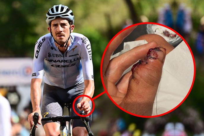 Chris Harper | Chris Harper si je huje poškodoval prst na levi roki po padcu v deseti etapi Dirke po Franciji. | Foto Guliverimage
