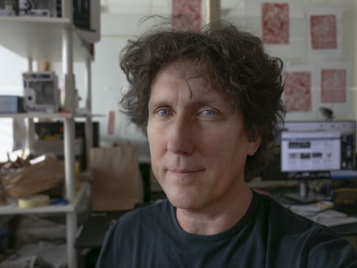 Iztok Šuc: Ne odlašajte z obiskom pri urologu do pozne starosti