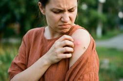 Komarji so že tu – tudi tigrasti. Kako se pravočasno zaščititi?