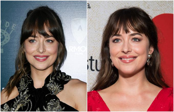 Na levi je Dakota z novim nasmehom, na desni pa s starim. | Foto: Getty Images