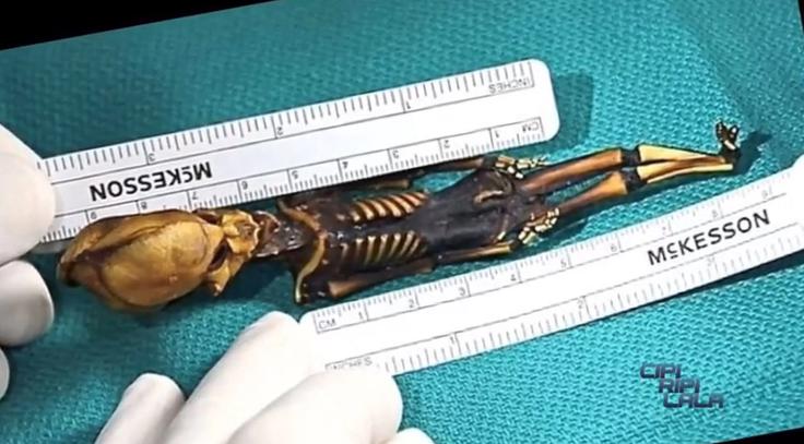Tudi če bi se rodila, atacamska deklica zaradi številnih napak v razvoju skoraj zagotovo ne bi mogla preživeti prav dolgo, so prepričani znanstveniki.  | Foto: YouTube
