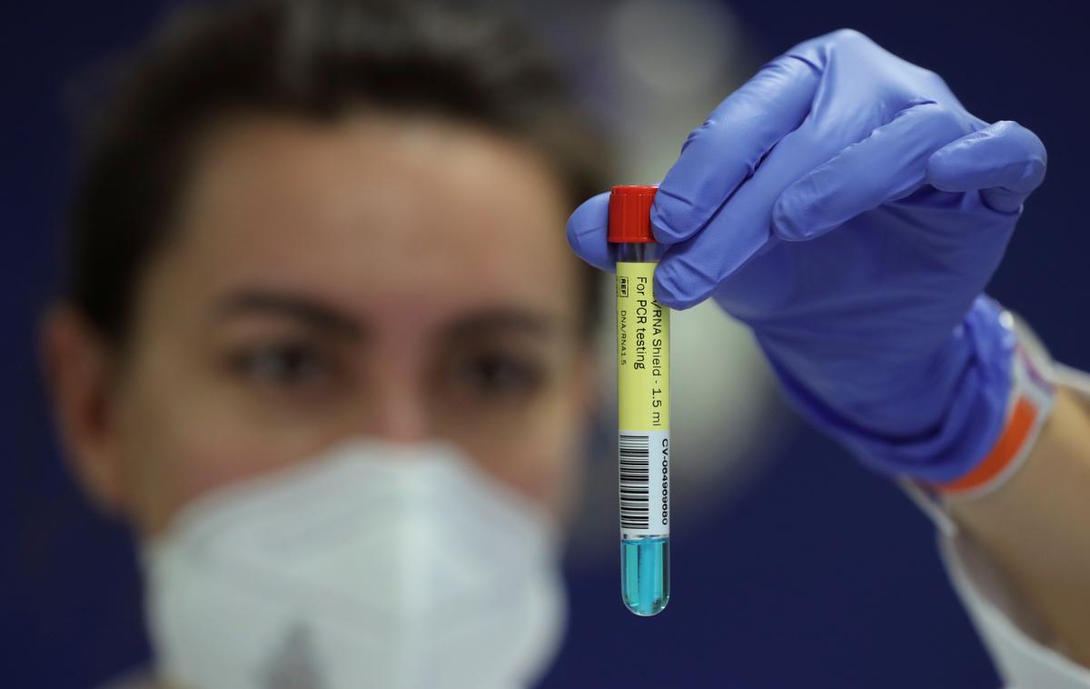 koronavirus covid test | Foto Reuters