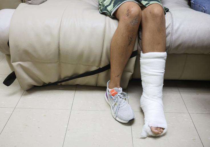 Utrpela je le zlom levega stopala ter nekaj prask in odrgnin. | Foto: Reuters