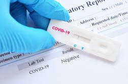 Covid-19 v Sloveniji: toliko okužb so potrdili v nedeljo