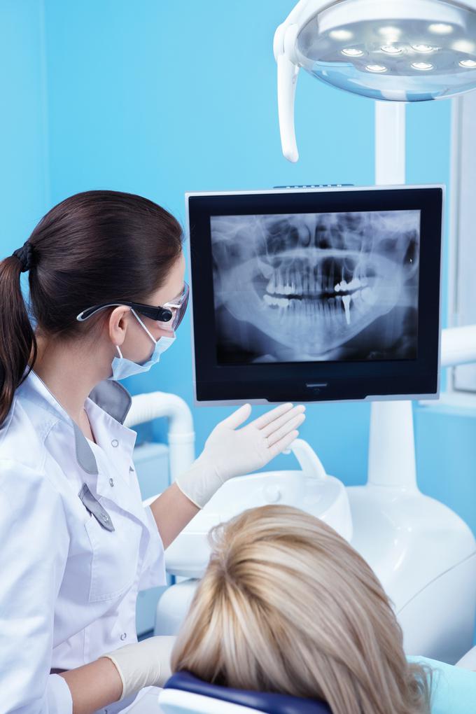 zobje pregled rentgen zobozdravnika | Foto: Thinkstock