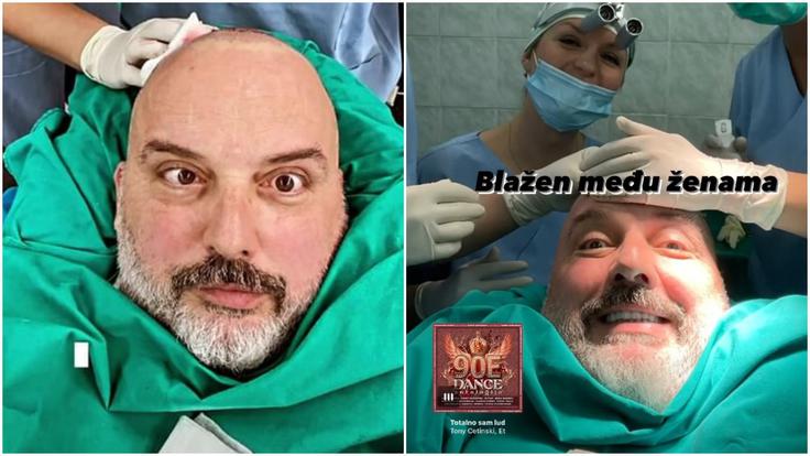 "Ni, kot se zdi," je zapisal ob enem od selfijev, posnetih med posegom, "malce se pretvarjam, da me boli." Ob drugi fotografiji pa je dopisal: "Blažen med ženami" in dodal svojo pesem Totalno sam lud (Popolnoma nor sem). | Foto: zajem zaslona/Instagram