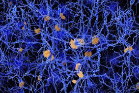 Dojemanje bolečine bi lahko razkrilo Alzheimerjevo bolezen