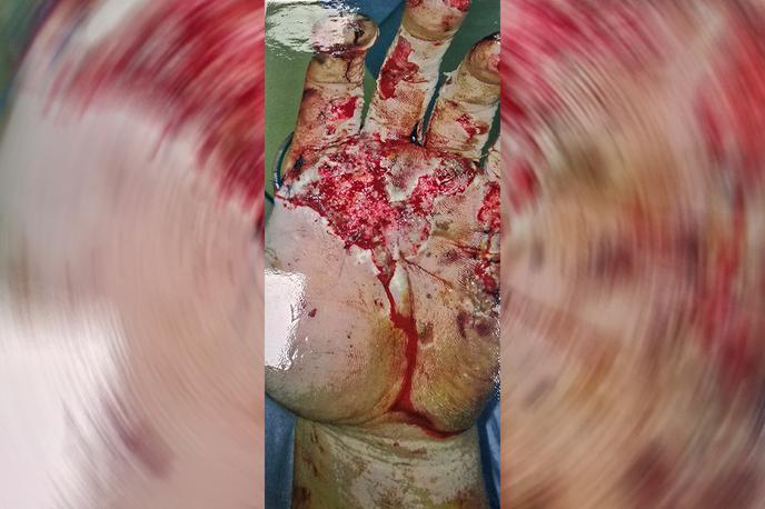 Petarde. | Policisti znova opozarjajo vse, ki se ne morejo upreti uporabi pirotehničnih sredstev, naj jih nikar ne kupujejo od preprodajalcev na tržnicah, bolšjih sejmih ali drugje na ulicah, prav tako naj ne kupujejo izdelkov, ki jih posamezniki prodajajo na družbenih omrežjih, saj predstavljajo resno nevarnost za poškodbe.  | Foto Policija