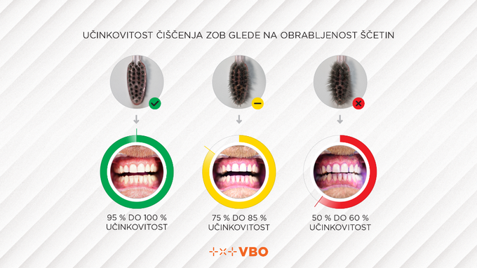 Izsledki raziskave obrabljenosti zobnih ščetk | Foto: Digitalno zobozdravstvo VBO