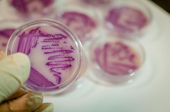 Z bakterijami salmonele je sicer po pojasnilih Vuzmove najpogosteje okuženo surovo meso. | Foto: Getty Images