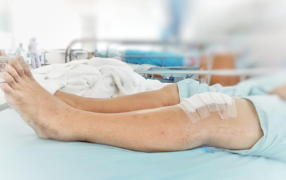 Medicofit, artroskopija kolena | Foto Medicofit