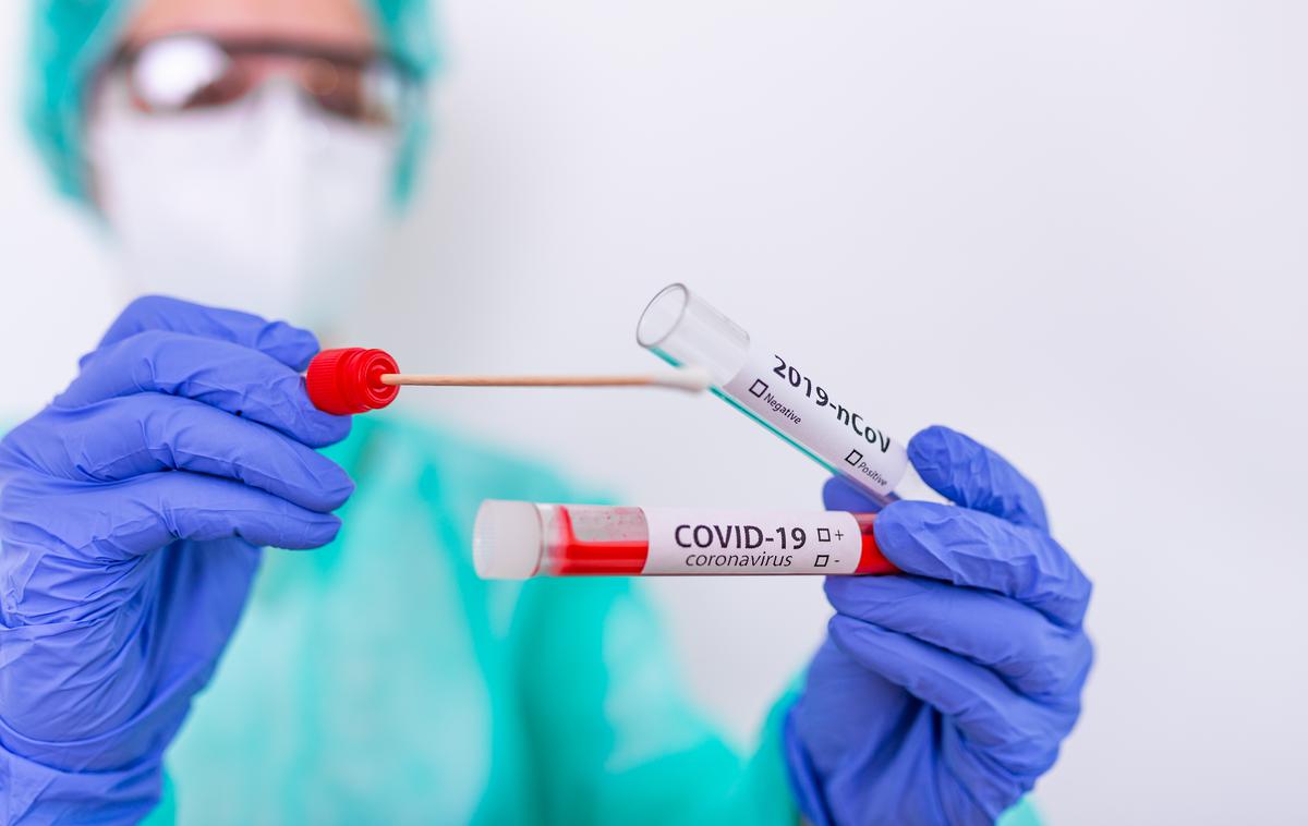 Koronavirus, Korona. Covid. Covid-19. Cepjenje. Test. Testiranje. Maske. | V Sloveniji je po oceni NIJZ trenutno 18.764 aktivnih primerov okužbe. | Foto Shutterstock