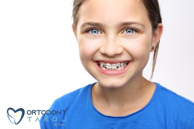 To je Maja, stara 12 let. Za njen nasmeh skrbi ortodont znamke ORTODONT TAKOJ®. Zdravi se s povračilom stroškov na napotnico. Zdravo in brezhibno zobovje bo imela v 18 mesecih. | Foto: 