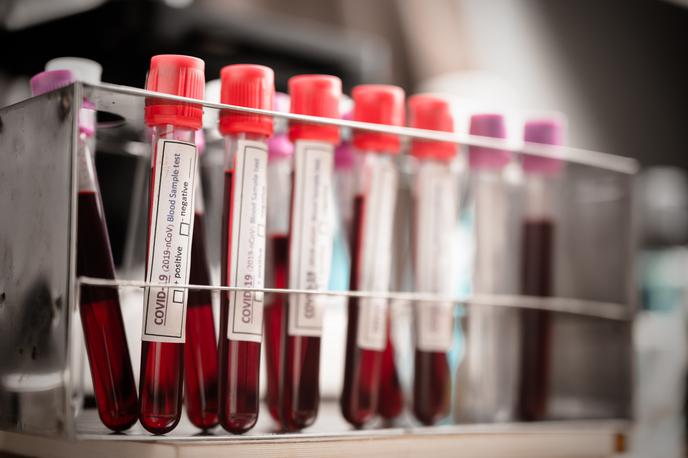 Covid. Koronavirus. Testiranje. Korona. Covid-19 | Število okuženih je bilo v primerjavi s prejšnjo nedeljo včeraj spet višje. | Foto Shutterstock