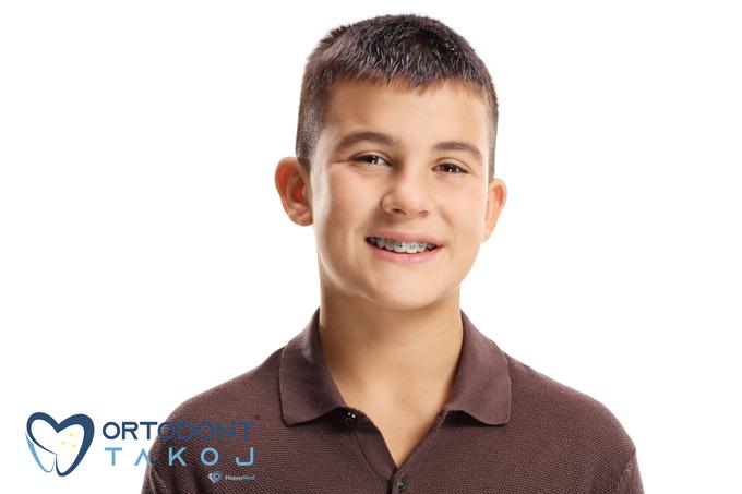 To je Simon, star 14 let. V ORTODONT TAKOJ® ga je mama naročila na drugo mnenje zaradi predlaganega puljenja zoba. Zob je ohranil. Očarljiv nasmeh bo dobil v 24 mesecih. V ORTODONT TAKOJ® pa mu bodo pripravili dokumente za povračilo stroškov zdravljenja na napotnico.  | Foto: 