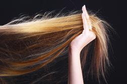 Je izpadanje las mogoče preprečiti?