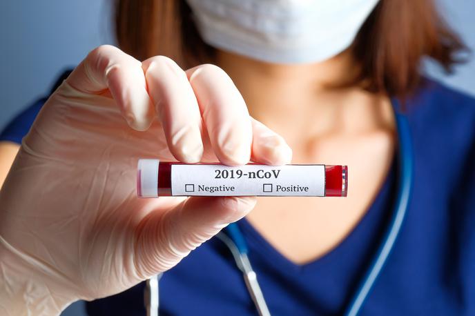 koronavirus | V sredo so pri nas potrdili 13 novih okužb z novim koronavirusom. | Foto Getty Images