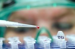 Ebole v Sloveniji ni, tudi drugi test je negativen (video)
