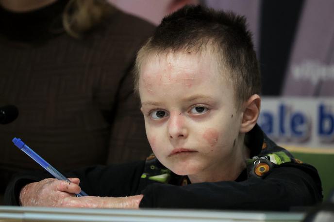 Miloš | V Sloveniji ima tovrstno bolezen manj kot deset otrok in odraslih, Miloš pa je edini, ki je tovrstno gensko terapijo v UKC Ljubljana že prejel. | Foto STA