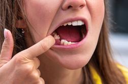Že en izpadel zob lahko povzroči hude težave