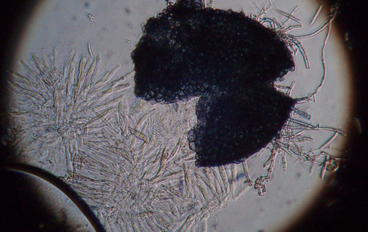 gliva fusarium graminearum | Gliva fusarium graminearum povzroča bolezni več vrst žit, škodo zaradi bolezni, ki jih povzroča, ocenjujejo na več milijard evrov. | Foto CIMMYT